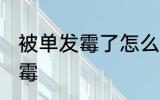 被单发霉了怎么洗掉 如何解决被单发霉
