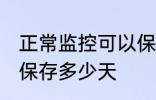 正常监控可以保存多久 正常监控可以保存多少天