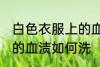 白色衣服上的血渍怎么洗 白色衣服上的血渍如何洗