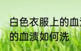 白色衣服上的血渍怎么洗 白色衣服上的血渍如何洗